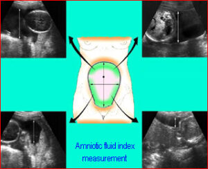Phelan Normal Basic OB Ultrasound - Department of Obstetrics and Gynecology Faculty ...