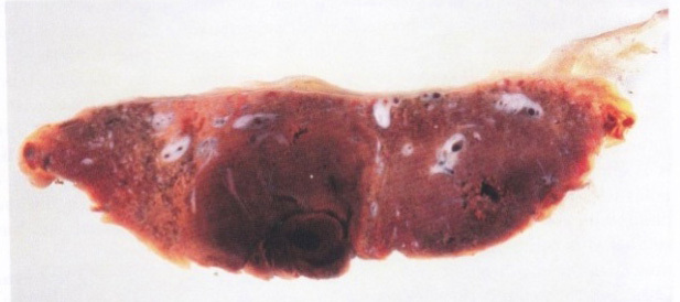 placenta13a
