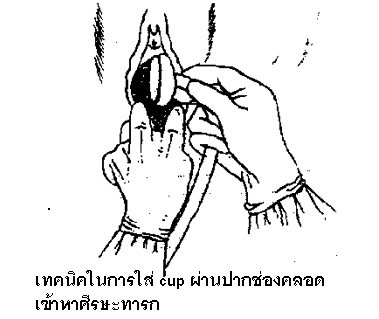 2-2