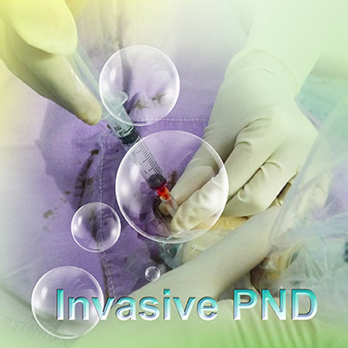 Invasive Prenatal Diagnosis