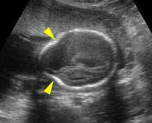 Abnormal Skull Shape - Department of Obstetrics and Gynecology Faculty ...