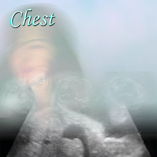Fetal Chest Anomalies