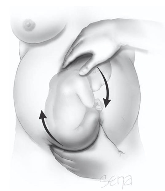 A pregnant person's belly with arrows pointing to the baby Description automatically generated