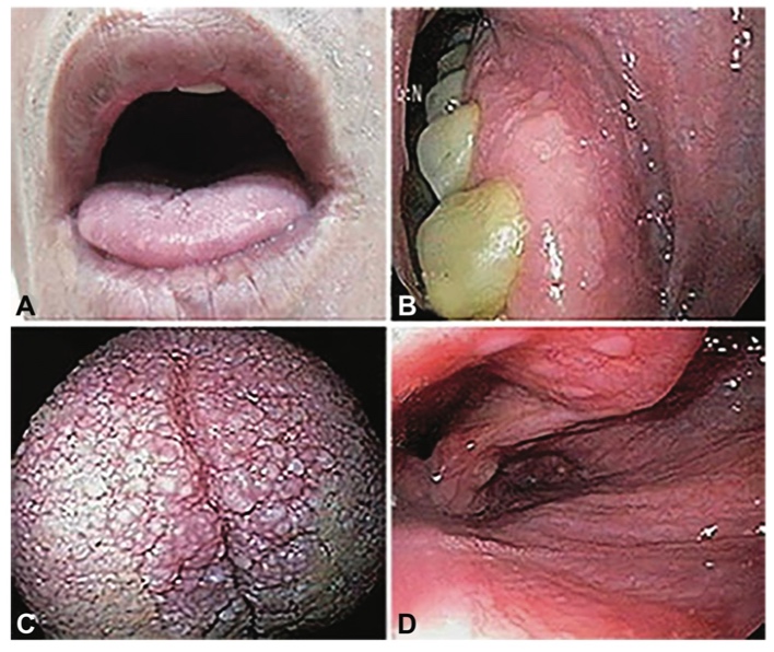 Close-up of several different types of sores Description automatically generated