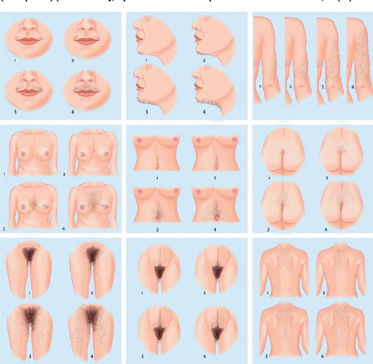 A collage of different types of hairy women Description automatically generated