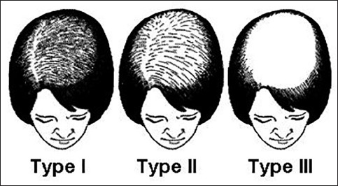 A diagram of different types of hair Description automatically generated