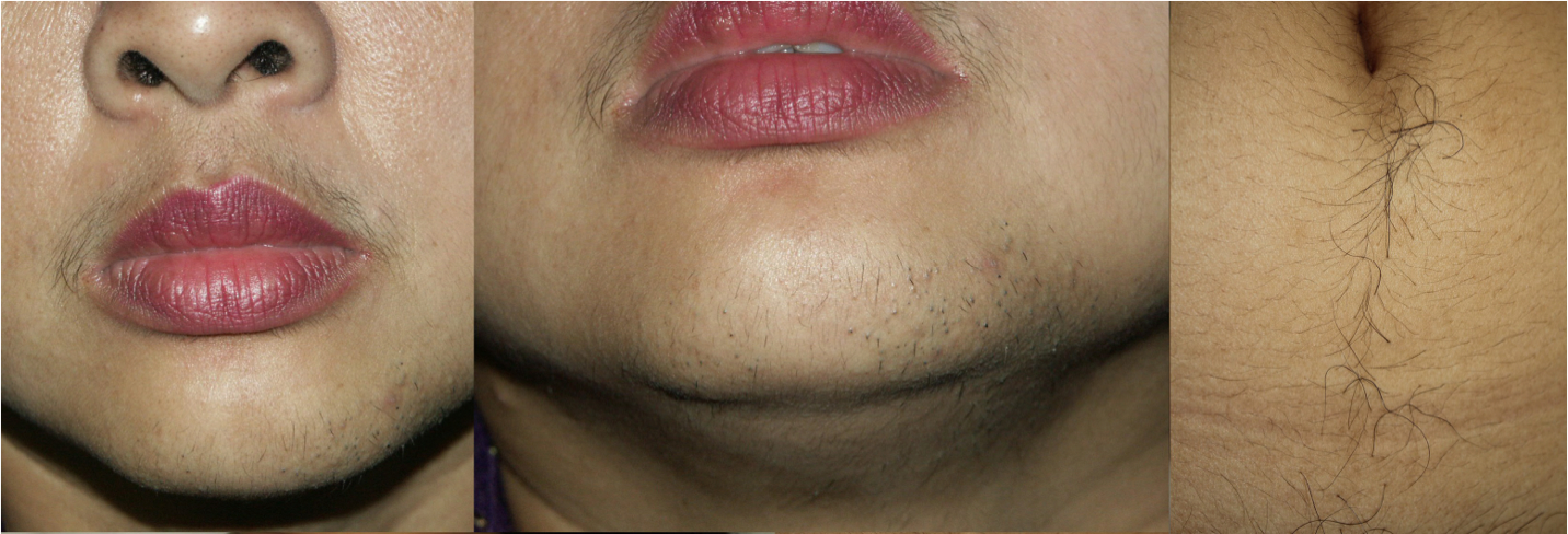 Close up of a person's chin Description automatically generated