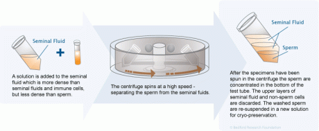 A diagram of a centrifuge Description automatically generated