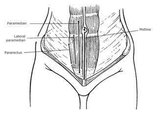 A picture containing linedrawing Description automatically generated