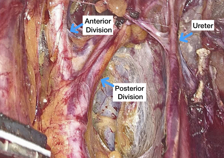 Close-up of a body Description automatically generated
