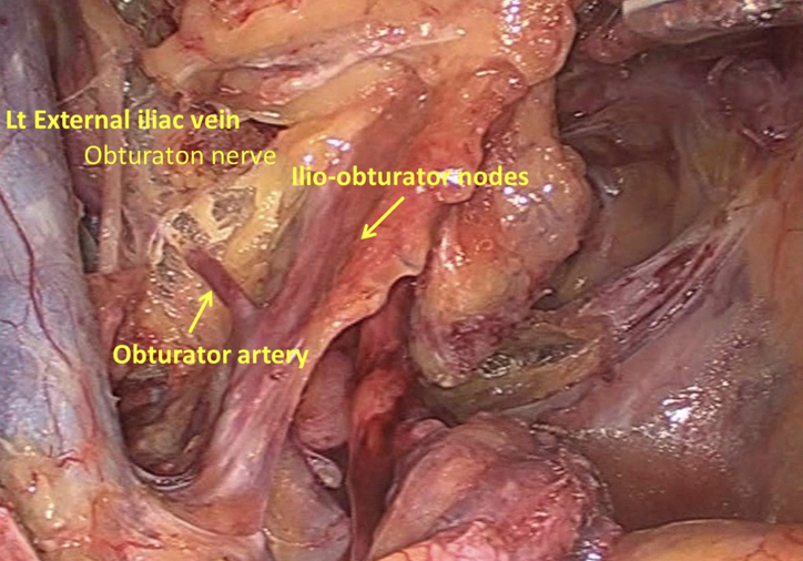 Close-up of a human body Description automatically generated