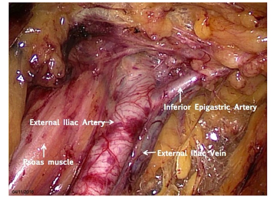 Close-up of a human body Description automatically generated