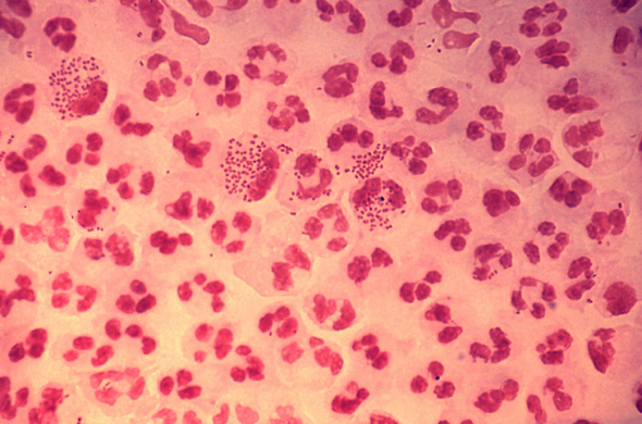 A red and white cell Description automatically generated with medium confidence
