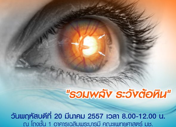 glaucoma2014