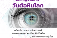 Glaucoma 2024 ed-1