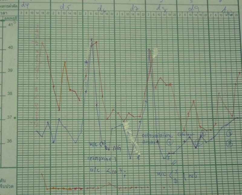 showed fever pattern of this patient. She had high-grade fever and clinical sepsis on PD2 and PD4