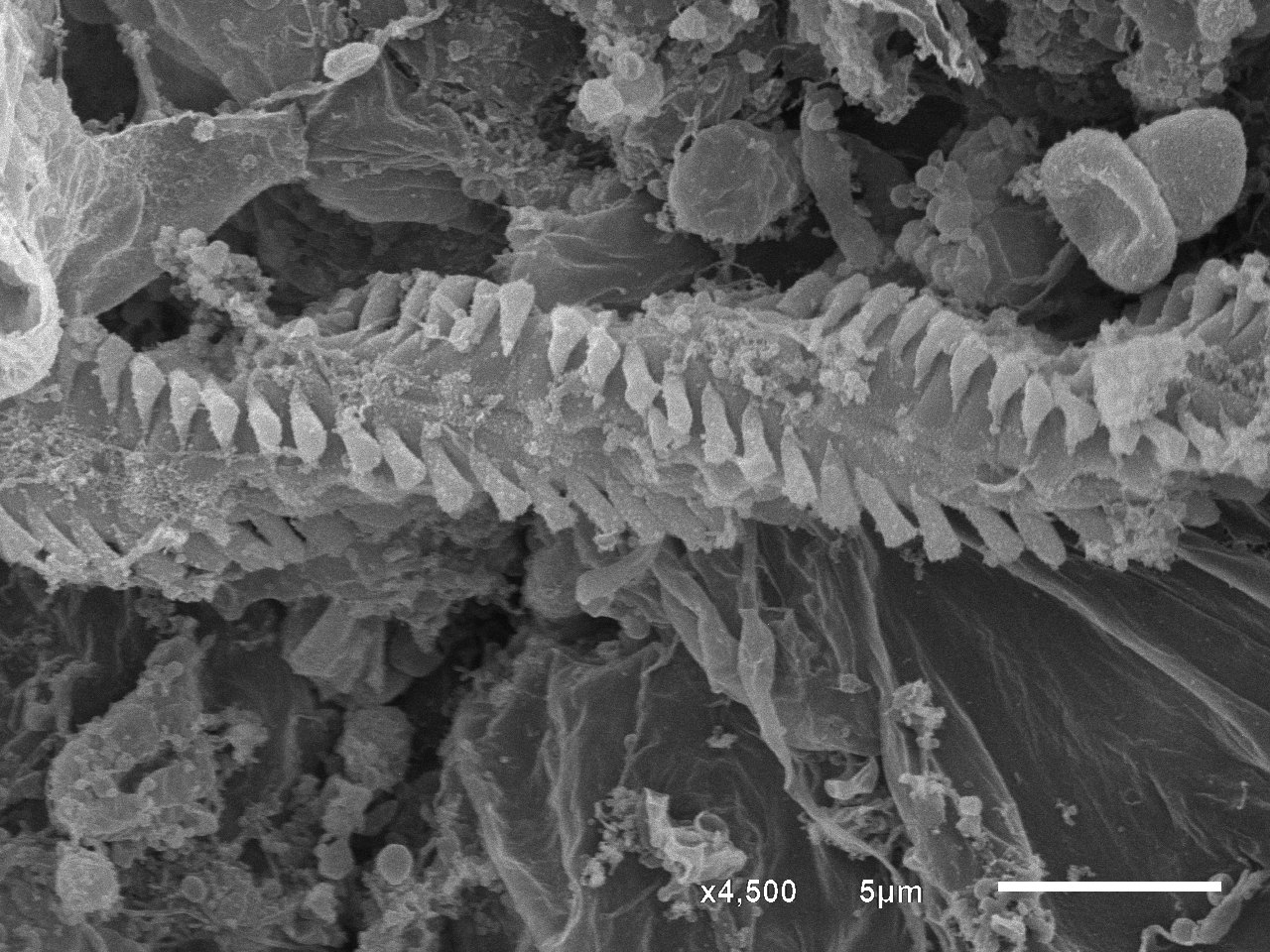 SEM micrograph supplied by the EM Unit, showing a textured biological sample surface and a 5 micrometer scale bar