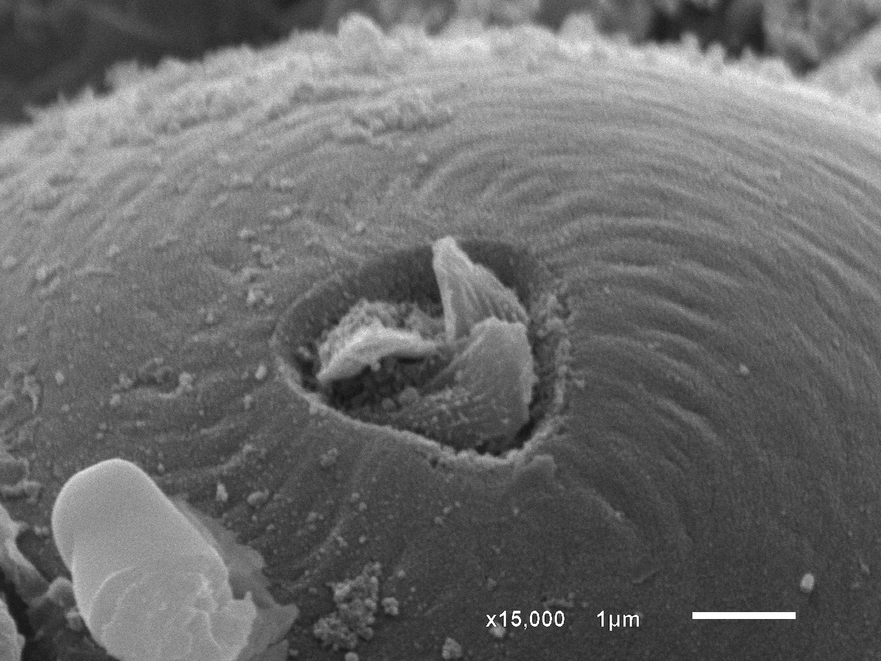 SEM micrograph of a biological sample surface with a 1 micrometer scale bar