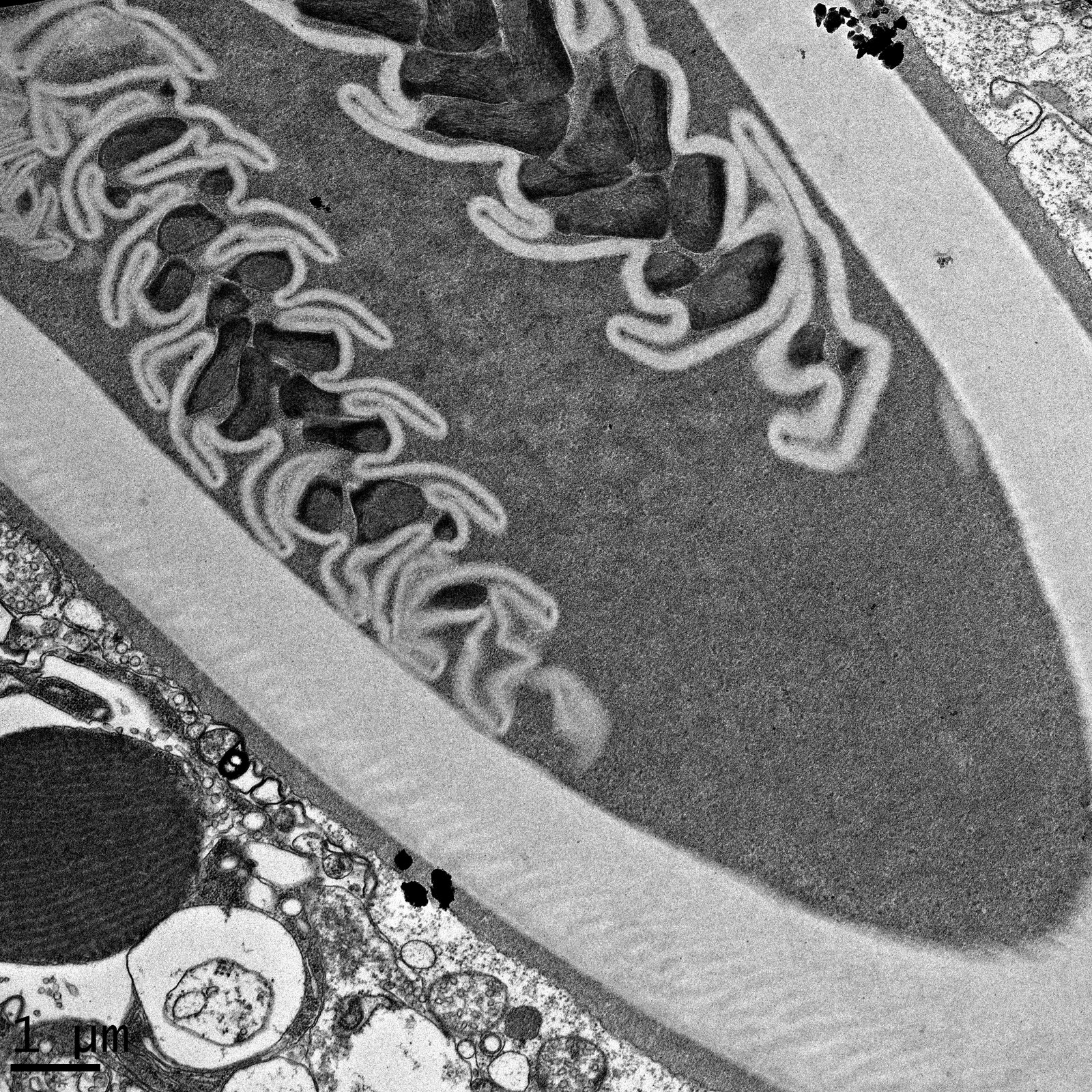 TEM micrograph supplied by the EM Unit, showing fine internal structures and a 1 micrometer scale bar