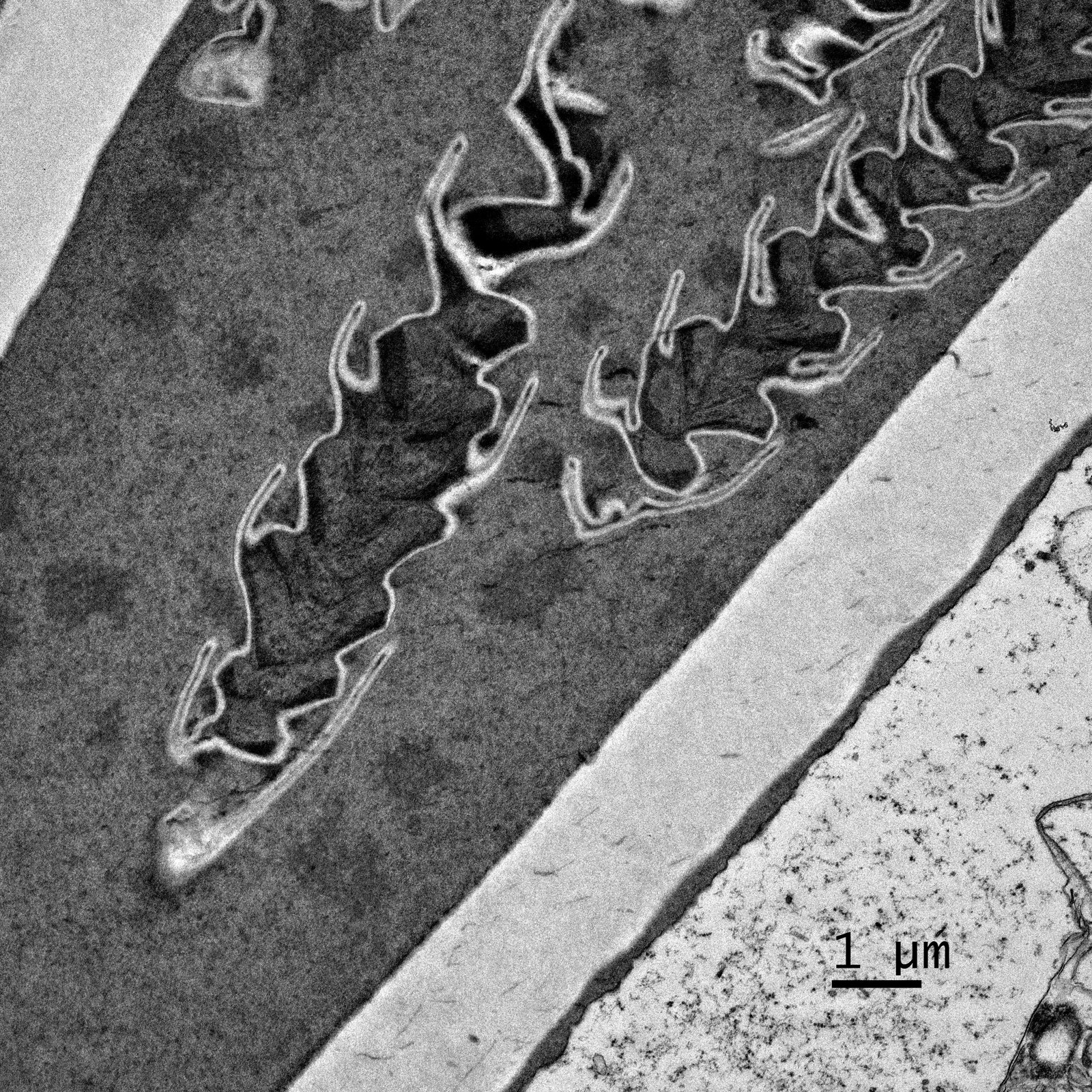 TEM micrograph of biological ultrastructure with a 1 micrometer scale bar