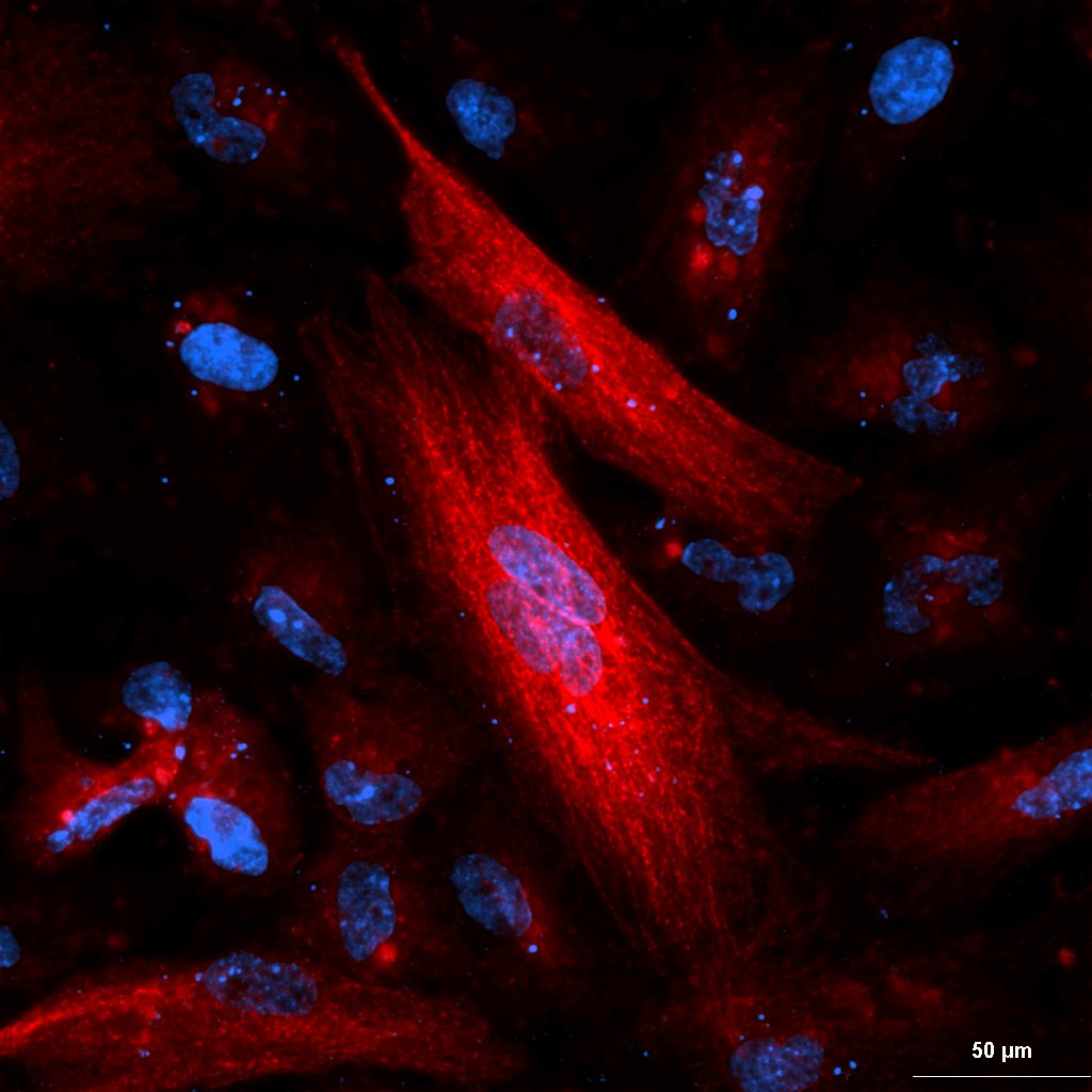 ภาพฟลูออเรสเซนต์ของเซลล์ แสดง microtubule (สีแดง) และนิวเคลียส (สีฟ้า) ถ่ายด้วย Nikon High-Resolution Confocal Microscope Ti2-E / AX R / NSPARC เทคนิค NSPARC objective 10× zoom 5.8×